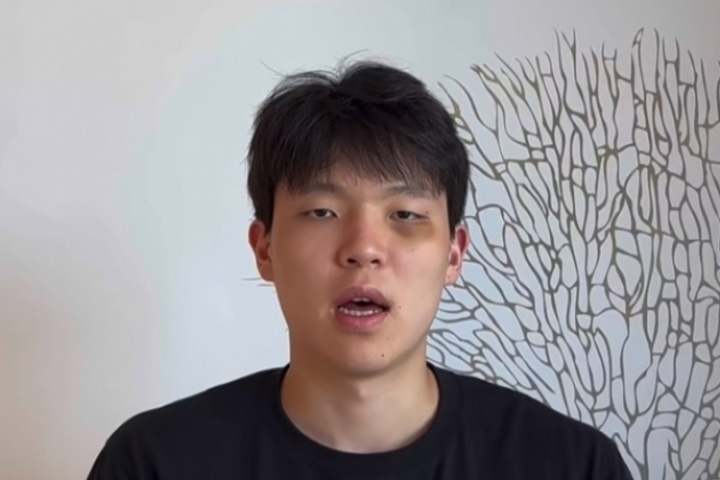 杨瀚森肿着熊猫眼回应东契奇：谢谢关注 等你的手机号 赛场见