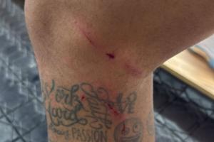 伤痕累累！刚复出的内马尔晒腿部划痕：每次都可能发生